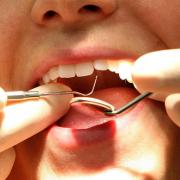 File photo dated 15/09/08 of a dentist at work, as figures show that the number of tooth extractions in hospital for children aged four and under has risen by almost a quarter in the last decade. PRESS ASSOCIATION Photo. Issue date: Tuesday March 21,