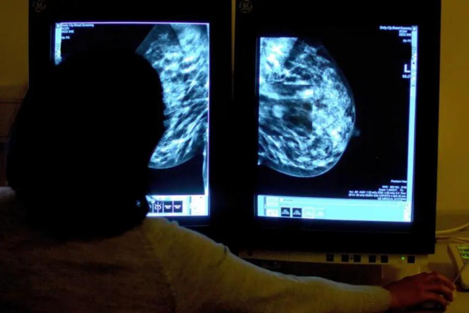 'More effective' breast cancer treatment on the way as breakthrough made